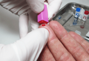Sida Info Service - TROD ou Test de dépistage rapide du VIH