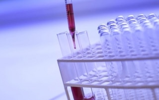 TROD ou Test de dépistage rapide du VIH